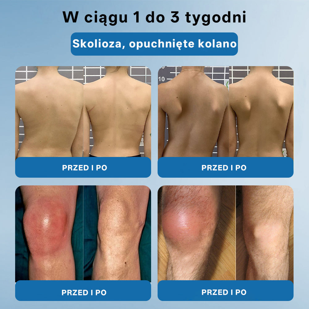 Apteka DOZ | ⭐Foulme® BPC-157 Krem regenerujący stawy 🦴💥 Skutecznie łagodzi artretyzm, neuropatię, reumatyzm, kontuzje sportowe i wiele więcej 👍